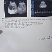 孕16周了，有一样的宝妈吗😊