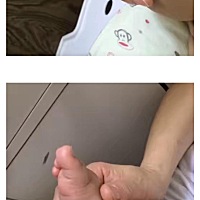 宝宝两只脚丫内侧有对称的凸起小肉包，按着是软的，也没见他有什么反应，有哪家宝宝也有这种情况嘛