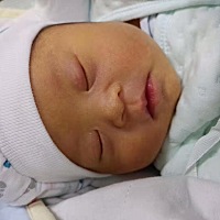 宝宝昨天凌晨生的，今天医生说孩子可能是唐氏儿，叫去做个检查，心里有点慌，各位懂的还请帮忙看看...