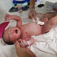 说说我的顺转剖经历 怀着小瑷第40+6周的时候，毅然选择住院催产，当天中午住院，各种检查，胎儿b超显示7...