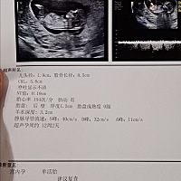 麻烦各位大神给看看，12周＋1天