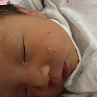 有宝妈知道宝宝脸上的白点是什么吗 一出生就有