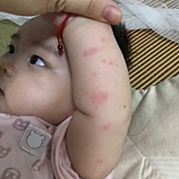 有谁知道这是长了什么吗？