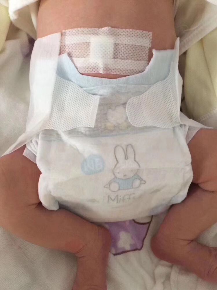 出生到现在几千尿不湿已经没了😓