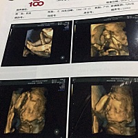 快生了，我想生个女儿，四维照发你们看看，你们看看是男孩还是女孩