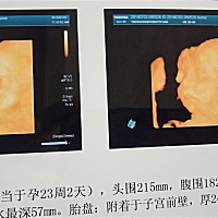 看得出是男孩还是女孩吗？谁会看？