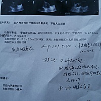 医生说还不能确定宫内宫外，请看的懂的宝妈给看看。目前不到6周，昨天晚上有点点褐色分泌物，医生说是要...