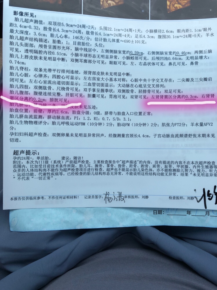 急急急！！！有宝妈懂吗 宝宝四维检查有点肾盂分离 这个数值严重吗？有经验的宝妈请cij