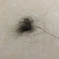 有没有宝妈从4个月一直脱发的，正不正常啊，我都快疯了，洗一次头发掉这么多