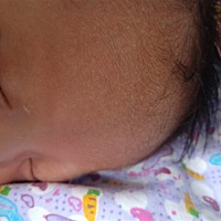 有宝妈知道宝宝十四天了 额头上有白色小疙瘩是怎么回事吗？宝宝能吃能睡也不闹