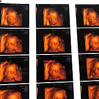 今天做了四维激动，大家帮我看看是男是女～