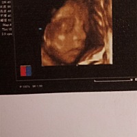 医生说宝宝长的漂亮，是不是提醒是个女宝