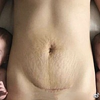 母爱的力量[心] 为所有妈妈和自己的勇敢付出点个赞吧 [赞] ​
