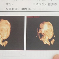 四维跟出生来的样子你们觉得像嘛