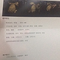 前几天出血了，然后去做的阴超，医生说看不出来是宫内还是宫外，也没有给开药，保胎什么的，这几天...