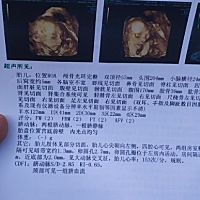 是男还是女有知道不