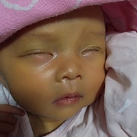 宝贝，对不起！ 看你一天比一天黄，妈妈心里非常难受。 宝妈，有类似新生儿溶血病患者吗…… 出生后...
