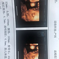 23周➕1天.今天刚做的四维 比实际小五天 .要多给小宝宝补补啦！