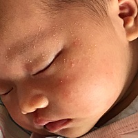 宝宝这两天脸上长了好多这种红点点，大家知道是啥吗？