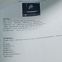还有三天就要住院开西瓜了