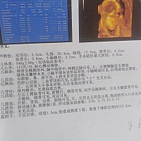 这是四维，想知道男女。谢谢能看懂的朋友告诉下啊。