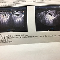 感谢 让我4.5年了第一次无意中怀孕 还是双胞胎😘太激动了