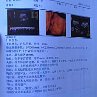 今天刚照的四维回来，医生说宝宝很配合，要给宝宝一个赞，可是我不会看男孩女孩，各位宝妈会看吗？