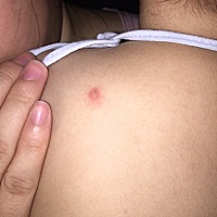 最近洗澡发现宝宝后背长了红点不知道是什么，有知道的吗？