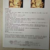 有谁看得懂，是男孩还是女孩。