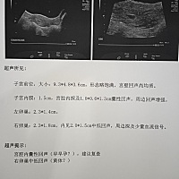 孕友们，能帮忙看看这是啥意思吗？