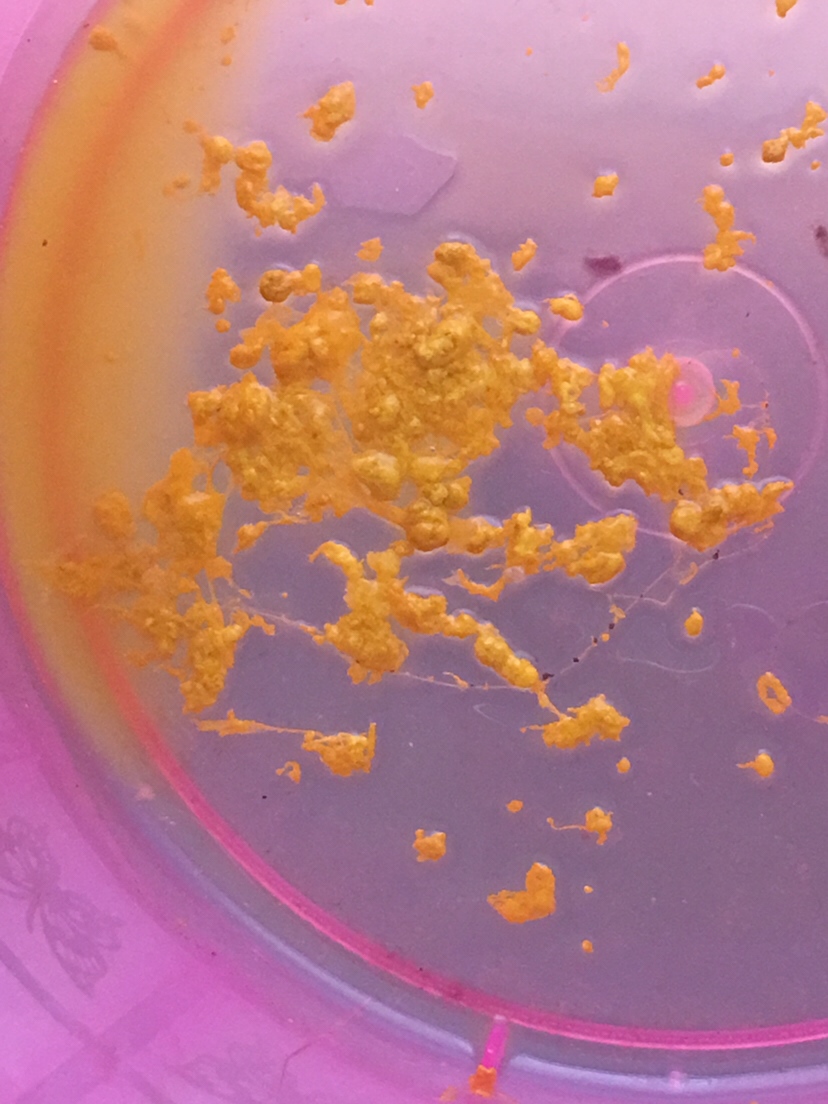 宝宝9天的大便性状