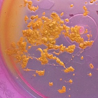 宝宝9天，母乳喂养，宝宝的大便这样子是正常的吗，一天大概8次左右…… 宝宝9天的大便性状