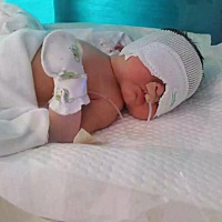 7月5日早产，产一名女婴，本是件高兴的事，可是孩子一出生就送儿科住院了，各项指标都不合格，心情...