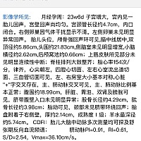 有人会看大排畸数据，辩男女吗