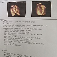 能看出来是男宝宝还是女宝宝吗，有点好奇