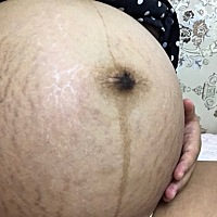 40周了还没要发动的感觉，妊娠纹看着真吓人啊。大家觉得是男宝女宝啊。