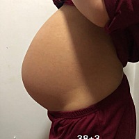 感谢我儿让我孕期过得舒适，没孕吐、没长纹、没耻骨疼，只是偶尔腰腿后背疼，皮肤也没有变差，也没有变...