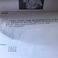 大家帮我看一看 这个问题严重不 大夫开了保胎药  让多休息