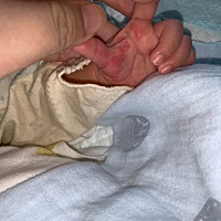 34天的宝宝早上洗手发现的是紫色 现在变成红色了 大家有知道这是怎么回事的吗？