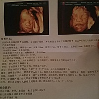 目前所有的检查一次通过，四维照给你们看看，猜猜看是乔治还是佩琪。