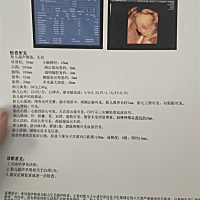 昨天做了四维，这是二胎，第一胎是儿子，特别希望这个是女儿，但是四维的时候好像看见是男孩了，有没有...