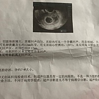 有看的懂的宝妈吗？二胎7周左右，严重贫血，胎儿偏小一周，现再在保胎，有些担心❤