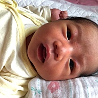 🈶️宝妈知道眼皮上面的小颗粒是什么吗？红色的2坨生下来就有，11天了也没有消除，好担心