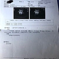 很好奇想知道男女，懂的大神麻烦帮忙看看