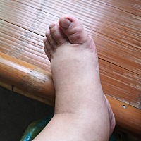 孕晚期真的是伤不起啊  干啥都累  特别是我这种胖子  脚已经肿的不成样子了  怀孕之前穿36码的鞋子 ...