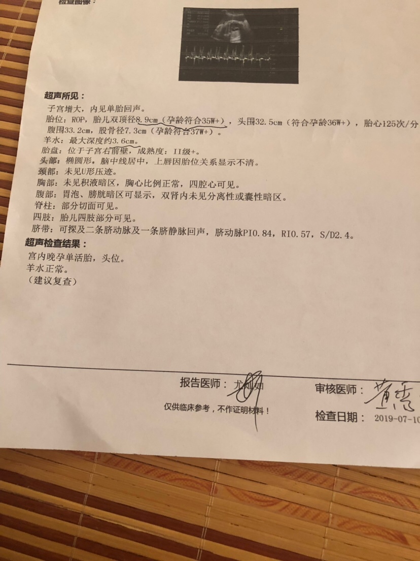 这是男孩子，还是女孩子，谁懂得看的