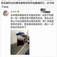 女孩子一定一定要注意