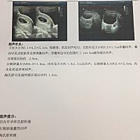 还愿。孕9周终于见胎心了。之前胎停过两次，这次怀孕特别紧张，停经7天后才去验血确认怀孕，孕酮和hcg数...