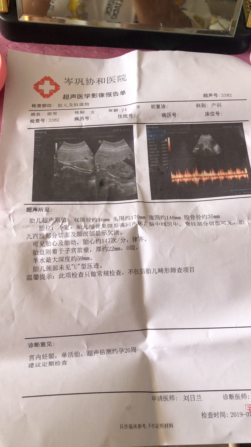 有会看的吗？帮忙看看亲们 好多都说我是女宝贝ne