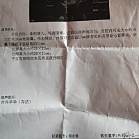 帮忙看下男孩女孩！谢谢孕妈们，1月1号的预产期，二胎觉得好有压力啊！农村人都得要生个男孩